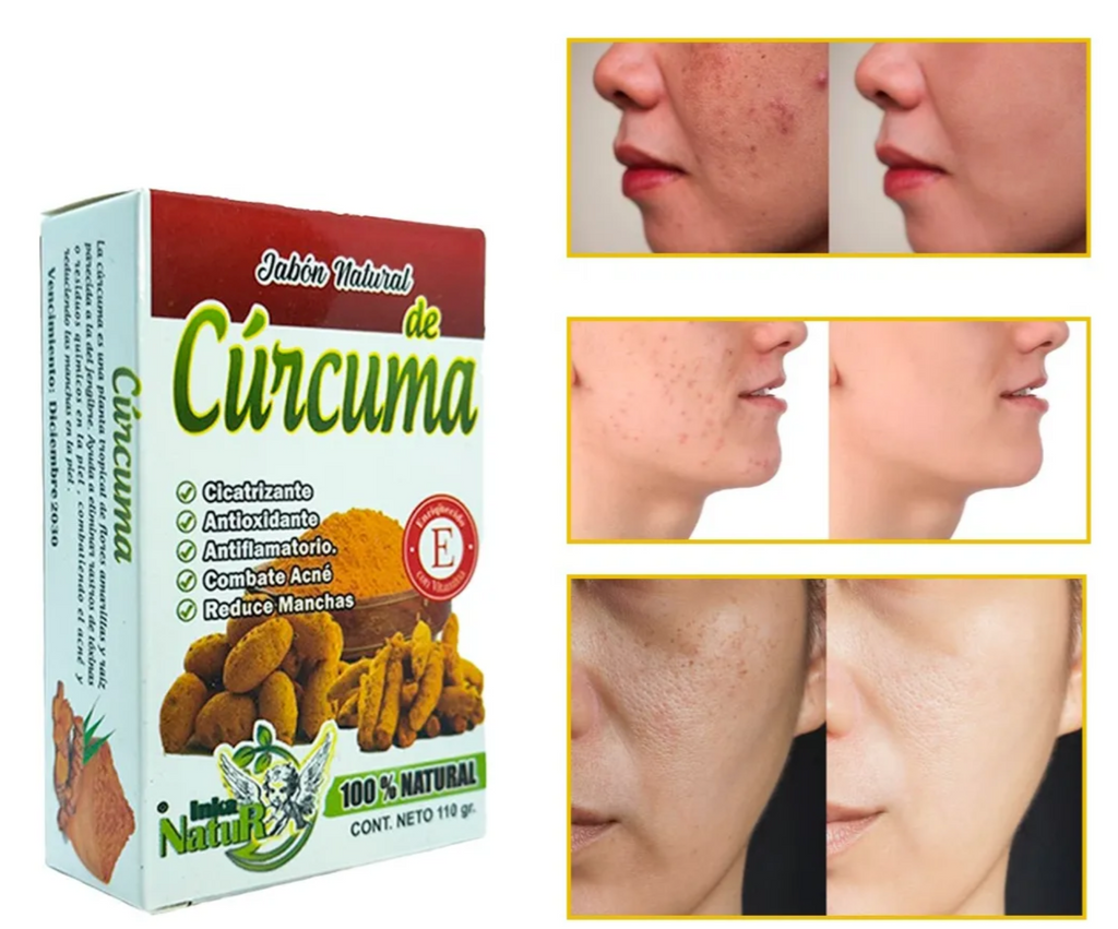 JABON NATURAL CORPORAL DE CURCUMA